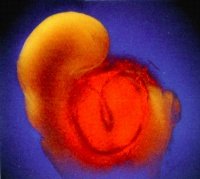 embryo early heartbeat